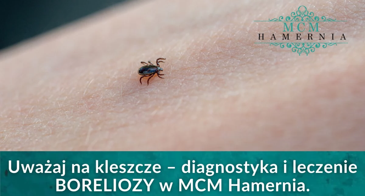 Zdrowie i uroda, Uwaga kleszcze! Sprawdź chronić gdzie szukać pomocy razie ugryzienia - zdjęcie, fotografia