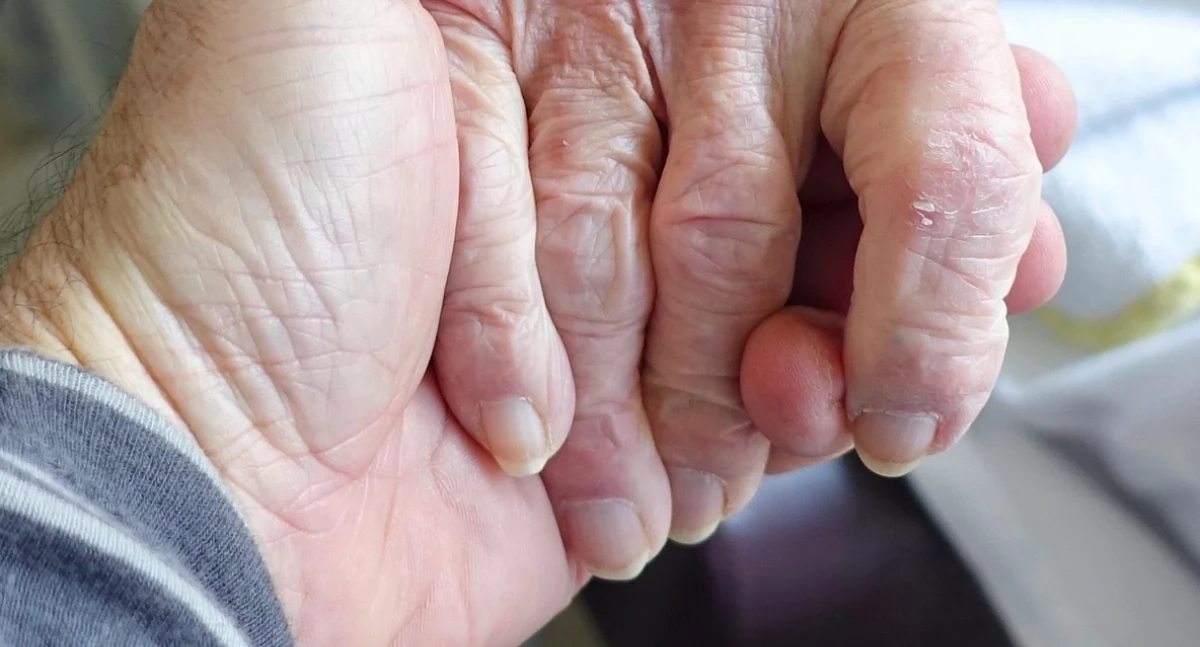 Interwencje, Samotni seniorzy górach niesie pomoc samotnym osobom powiecie suskim - zdjęcie, fotografia