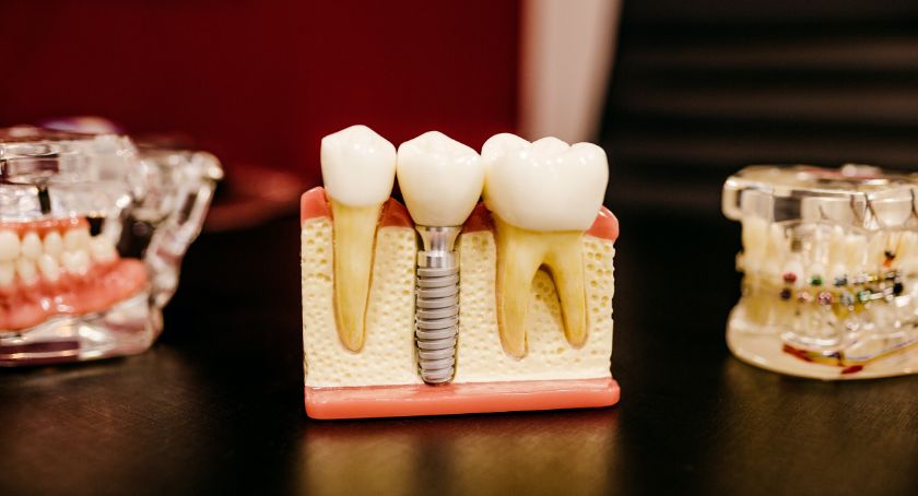 implant